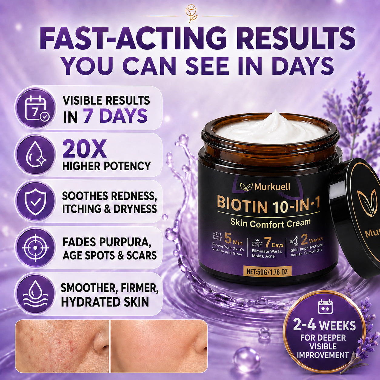 ✨Murkuell® Biotin 10-in-1 Skin Comfort Cream🍀